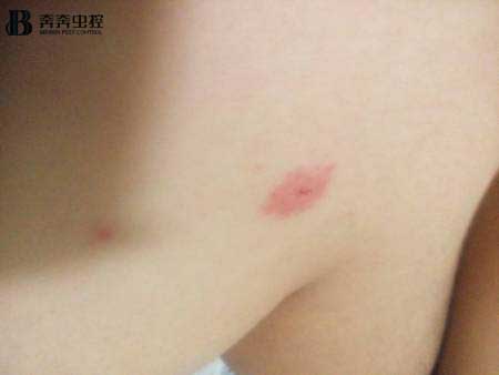 对抗蚊子块的&ldquo;终极武器&rdquo;究竟是什么？