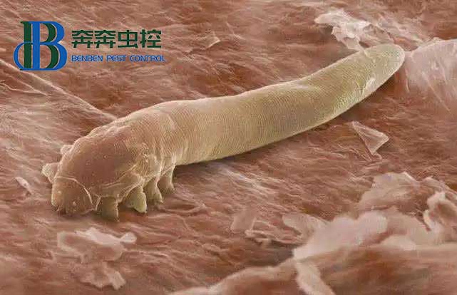 螨虫对身体的危害 如何去除尘螨